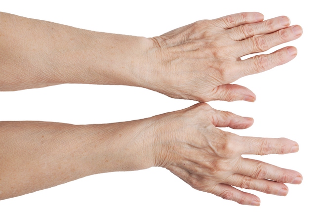 Возрастная кожа рук